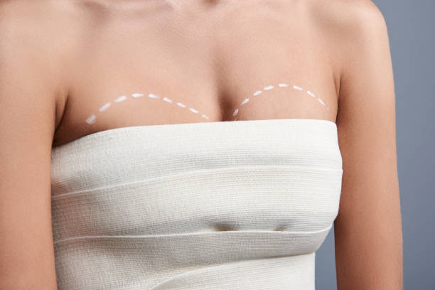 Breast Reduction in South Mumbai