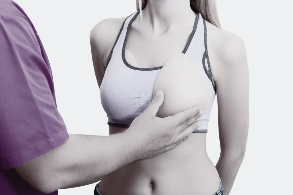 Post Cancer Breast Reconstruction