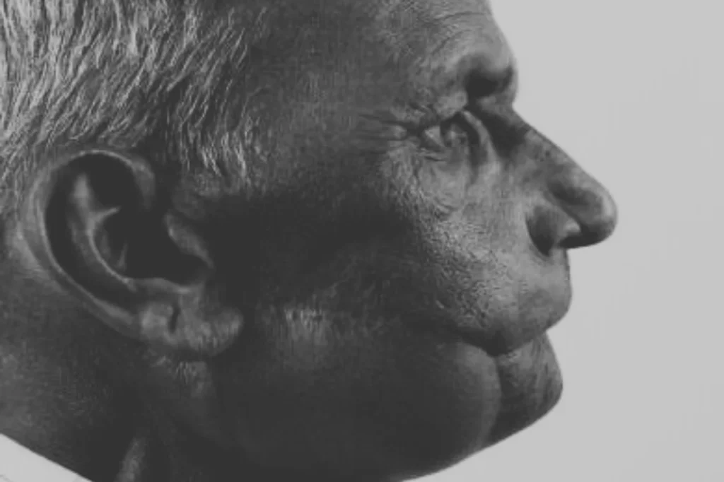 Post Cancer Reconstructive Surgery