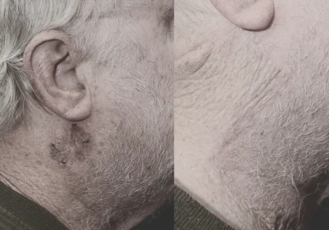 Skin & Soft Tissue Repair