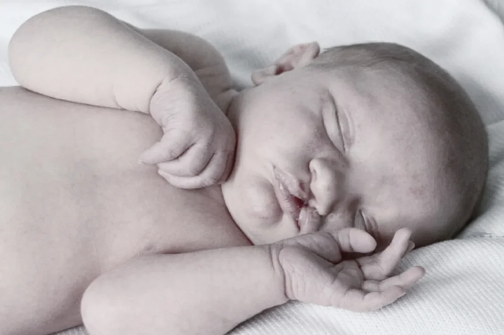 Pediatric Smile Surgery